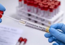 Empresa britânica lança teste rápido de COVID-19 para a indústria de eventos