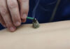 Congresso Internacional de Acupuntura Japonesa e Terapias Integrativas em Goiânia